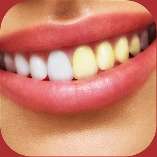وصفات تبييض الأسنان مجربة miFn7cHgghBEuR3MJWF_KSmipZvYqSmsTmZyv1M3mhhTp958XwmJZX58xRqLA2FcqCY