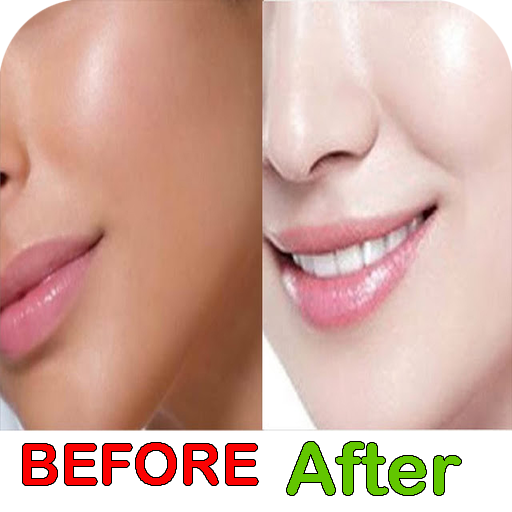 تفتيح البشرة بسرعة qymhzeOalDs5Rpiuq5VolfMsD_o217HlEYeSl7Zhrx69Nz5aP0VFo_VOv3WQrIicsg