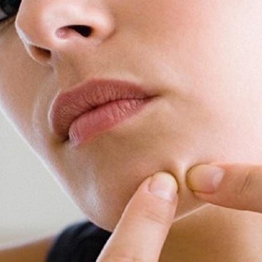 Acne Pimple Treatment vm84vQCxTa-CgXoBCh7qzMIe3Eqr5GMNu6FnQvK2q9Aahn41jUFZFTTAguD1fCugv07E
