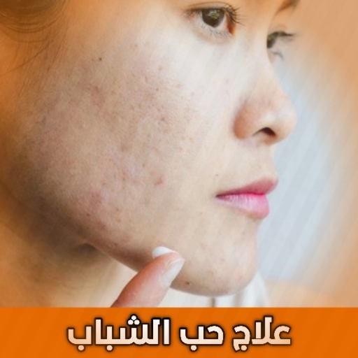 وصفات علاج حب الشباب بسرعة ClR2LzRSxfQsoxzkbGiGxoIAlaI9oPMbXcYxOy2wLDAsx48GAZ7Q2bnEy89TTf_qjj0
