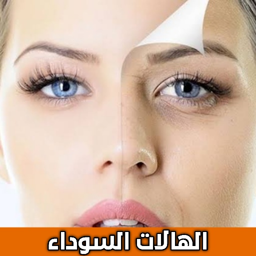 الهالات السوداء تحت العين jbHtKq2qV6KPTjMDF-_3XZJ7Gp3fzlgk5C5mw1qs-n_Px948ENMHp2EZSTXs4yBWkQ
