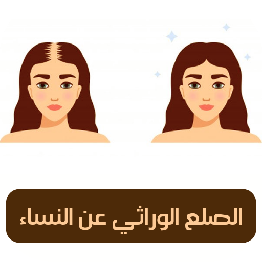 الصلع الوراثي عند النساء – صلع icon الصلع الوراثي عند النساء – صلع icon