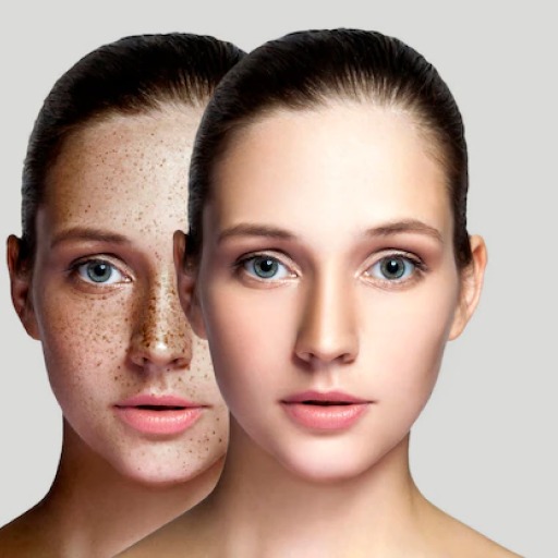 Pimple Remover Photo Editor nkw6FEufTpTkFjwYMujwKOumWtAYIZ3ZFzWG0rar0fGQ9zfnbzUvDOp7Cf1An62dCJg