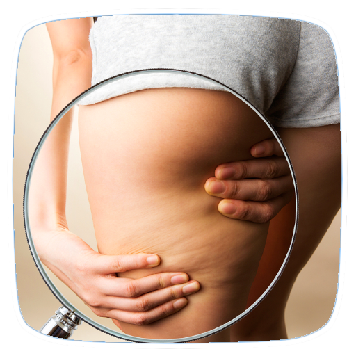 How to Get Rid of Cellulite pnfhgziKSTiG83K4gA4HvqBseVaWGkfadM3lOoNiI-t3Z6GF4cvjNJ8OeoRhuCtQp_U